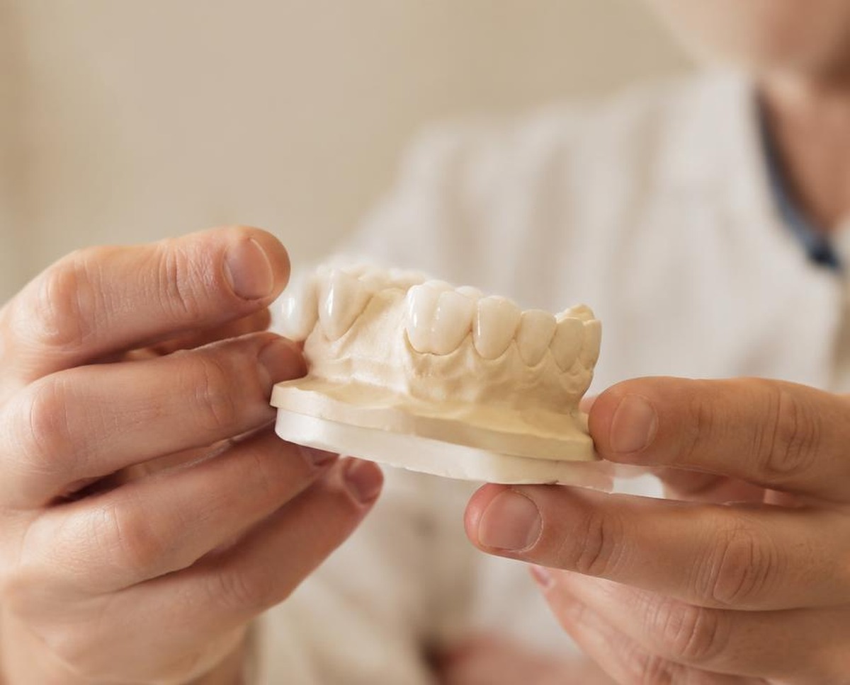 Prótesis dental de cerámica sostenida en la mano (imagen ilustrativa generada por IA)
